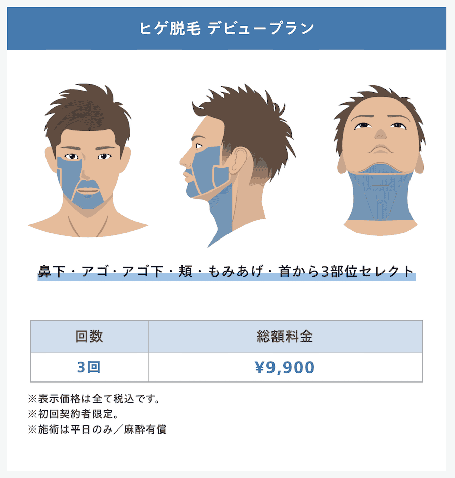 レジーナクリニックのヒゲ脱毛デビュープラン